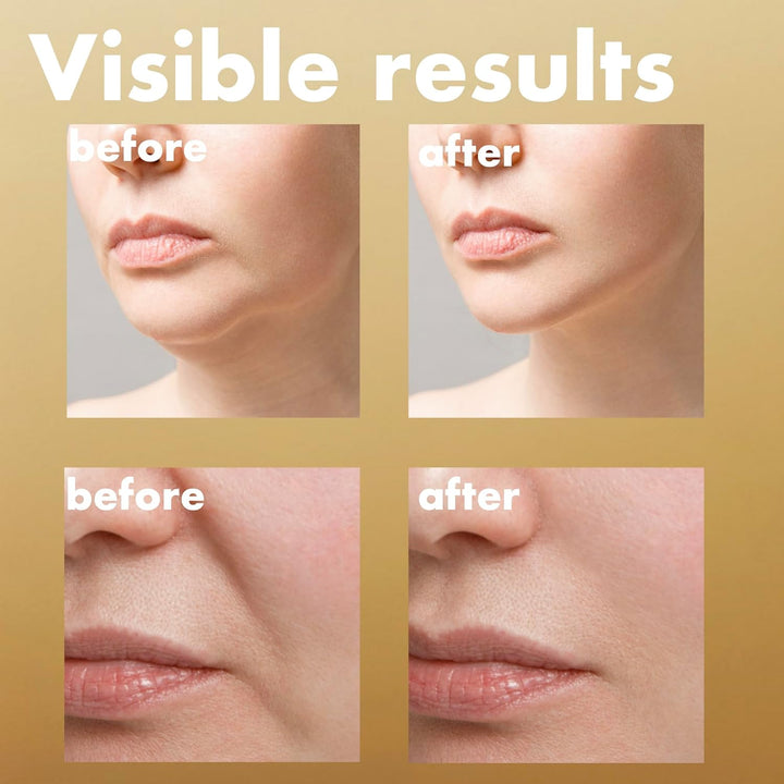 Isoi Intensive Lifting Serum