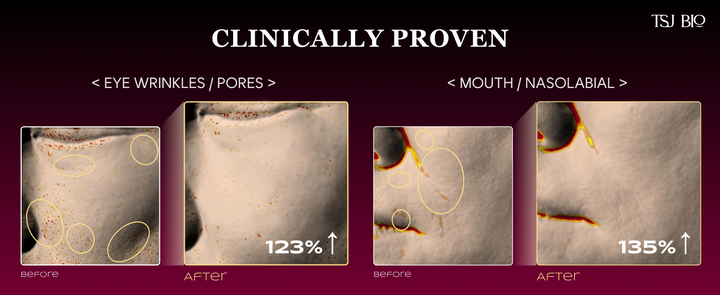 COMING SOON!  Exogelly Peel-Off Mask